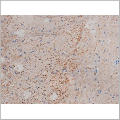 product-image-AAA30996_IHC2.jpg