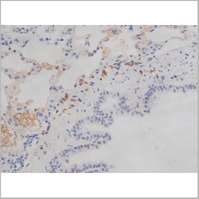 product-image-AAA30996_IHC3.jpg