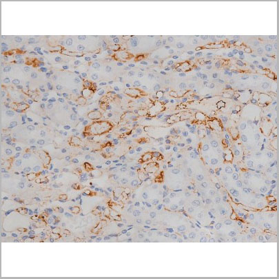product-image-AAA30996_IHC4.jpg