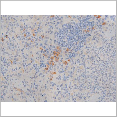 product-image-AAA30996_IHC5.jpg