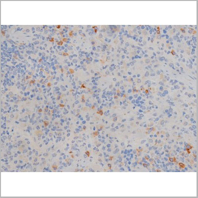 product-image-AAA30996_IHC6.jpg