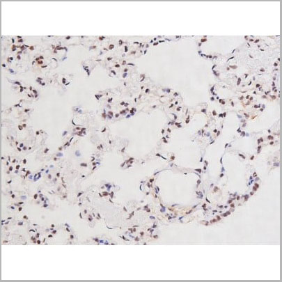 product-image-AAA30997_IHC10.jpg