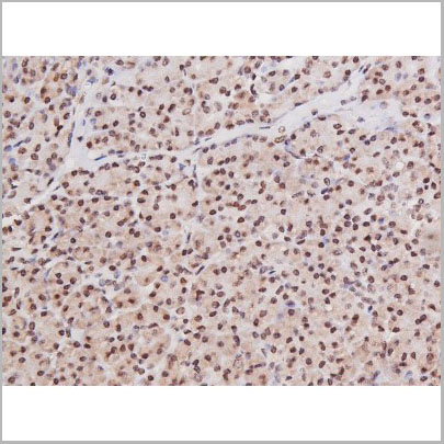 product-image-AAA30997_IHC3.jpg