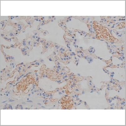 product-image-AAA30998_IHC11.jpg