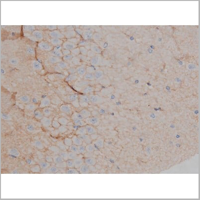 product-image-AAA30998_IHC12.jpg