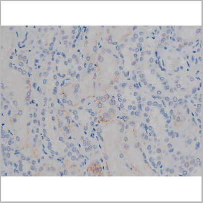 product-image-AAA30998_IHC2.jpg