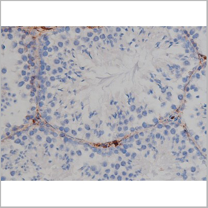 product-image-AAA30998_IHC4.jpg