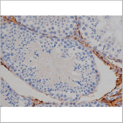 product-image-AAA30998_IHC5.jpg