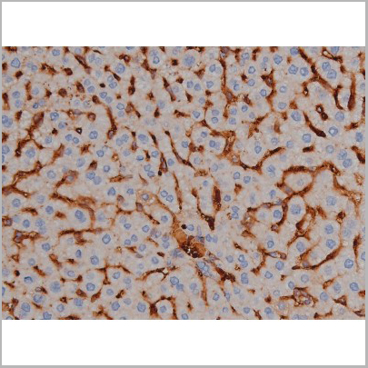product-image-AAA30998_IHC6.jpg