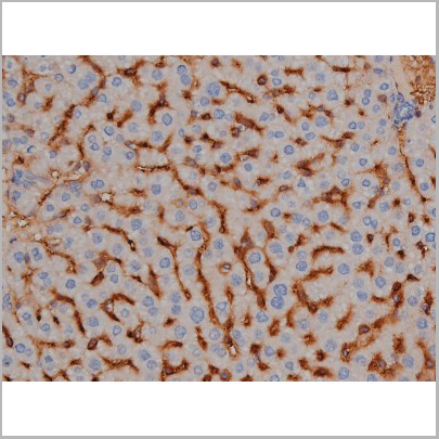product-image-AAA30998_IHC7.jpg