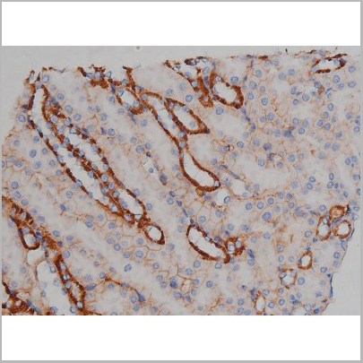 product-image-AAA30998_IHC8.jpg