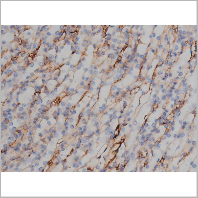 product-image-AAA30998_IHC9.jpg