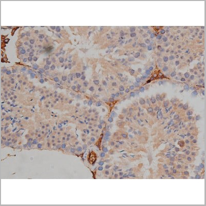product-image-AAA30999_IHC11.jpg
