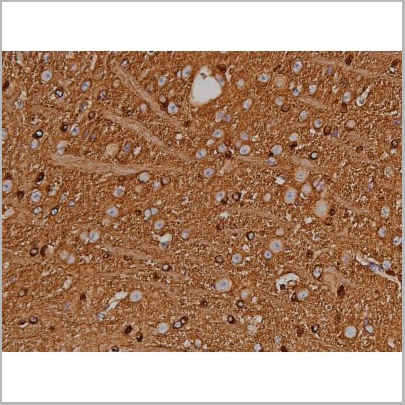 product-image-AAA30999_IHC12.jpg
