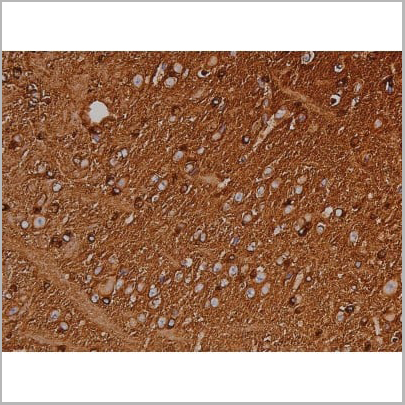 product-image-AAA30999_IHC13.jpg