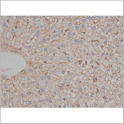 product-image-AAA30999_IHC14.jpg