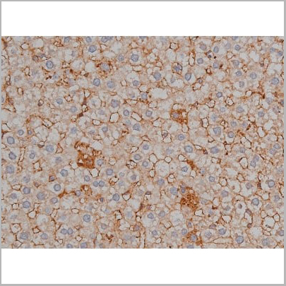 product-image-AAA30999_IHC15.jpg