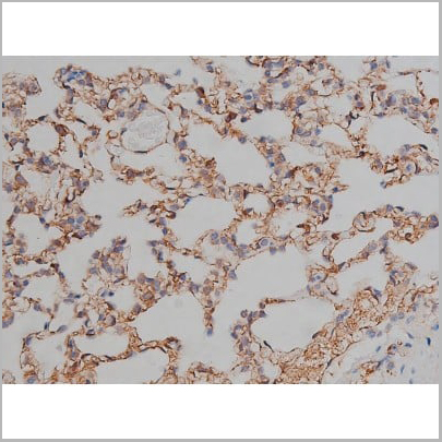 product-image-AAA30999_IHC16.jpg