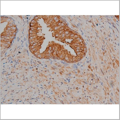 product-image-AAA30999_IHC2.jpg