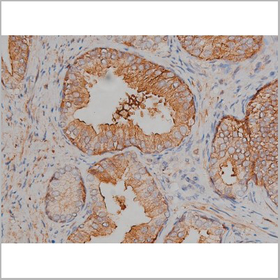 product-image-AAA30999_IHC3.jpg