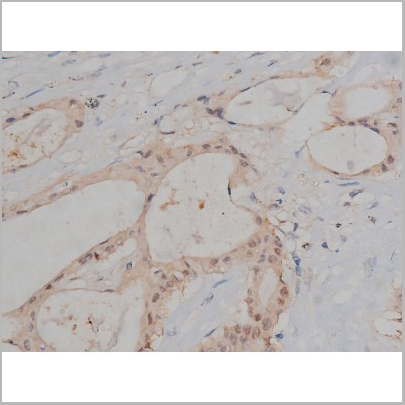 product-image-AAA30999_IHC4.jpg