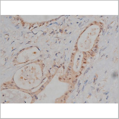 product-image-AAA30999_IHC5.jpg
