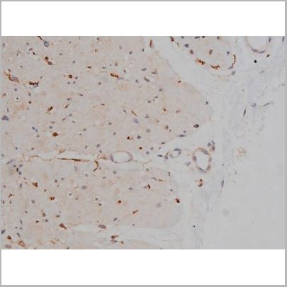 product-image-AAA30999_IHC6.jpg