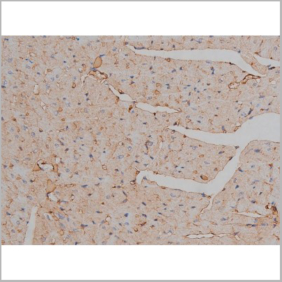 product-image-AAA30999_IHC8.jpg