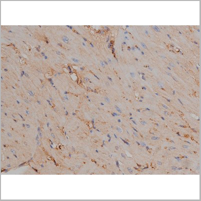 product-image-AAA30999_IHC9.jpg