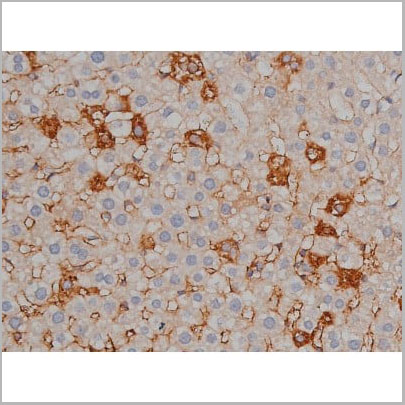 product-image-AAA31000_IHC11.jpg