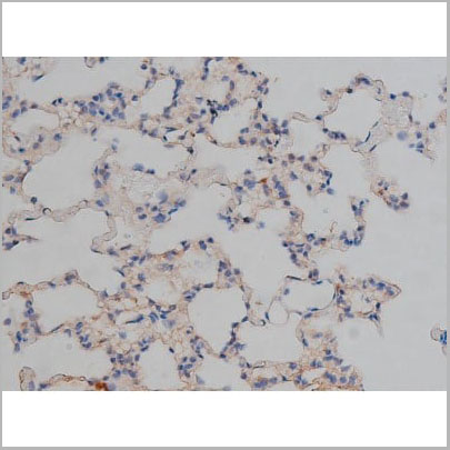product-image-AAA31000_IHC12.jpg
