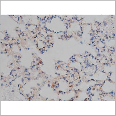 product-image-AAA31000_IHC13.jpg