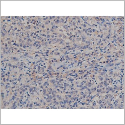 product-image-AAA31000_IHC3.jpg