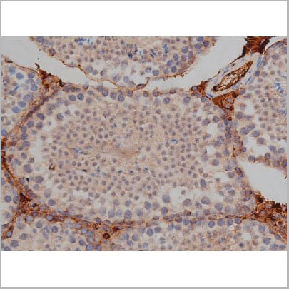 product-image-AAA31000_IHC4.jpg