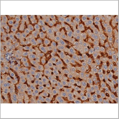 product-image-AAA31000_IHC5.jpg