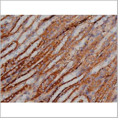 product-image-AAA31000_IHC6.jpg
