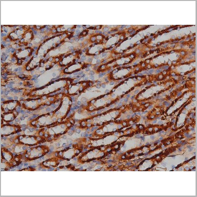 product-image-AAA31000_IHC7.jpg