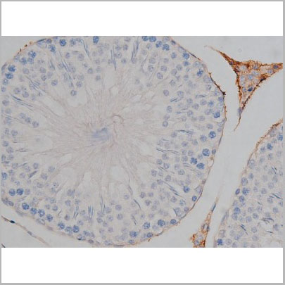 product-image-AAA31000_IHC8.jpg