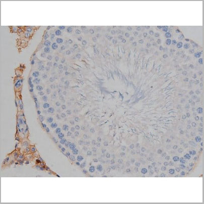 product-image-AAA31000_IHC9.jpg