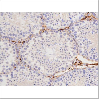 product-image-AAA31001_IHC2.jpg