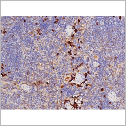 product-image-AAA31001_IHC3.jpg