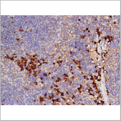 product-image-AAA31001_IHC4.jpg