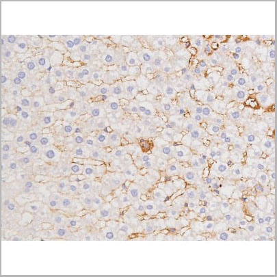 product-image-AAA31001_IHC5.jpg