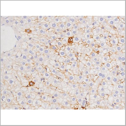 product-image-AAA31001_IHC6.jpg