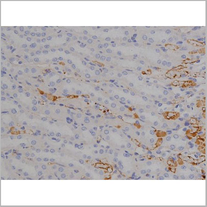 product-image-AAA31001_IHC7.jpg