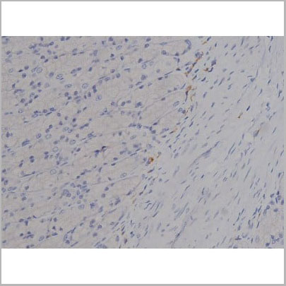 product-image-AAA31001_IHC8.jpg
