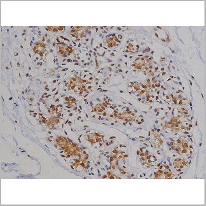 product-image-AAA31003_IHC3.jpg