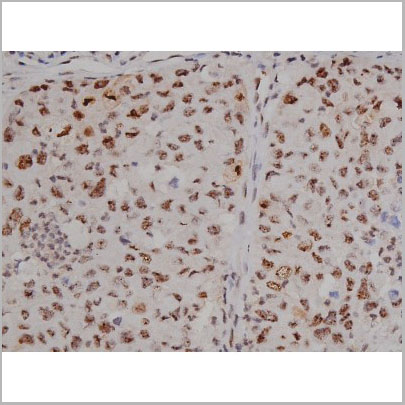 product-image-AAA31003_IHC4.jpg