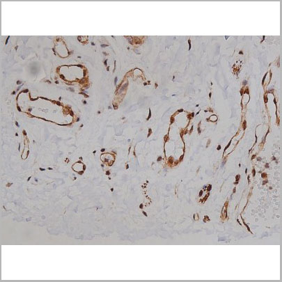 product-image-AAA31003_IHC5.jpg