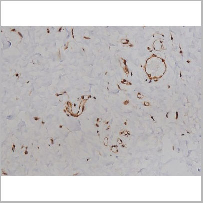 product-image-AAA31003_IHC6.jpg